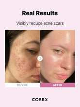 Cargar imagen en el visor de la galería, COSRX The Niacinamide 15 Serum Acne