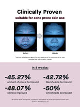 Cargar imagen en el visor de la galería, COSRX The Niacinamide 15 Serum Acne

